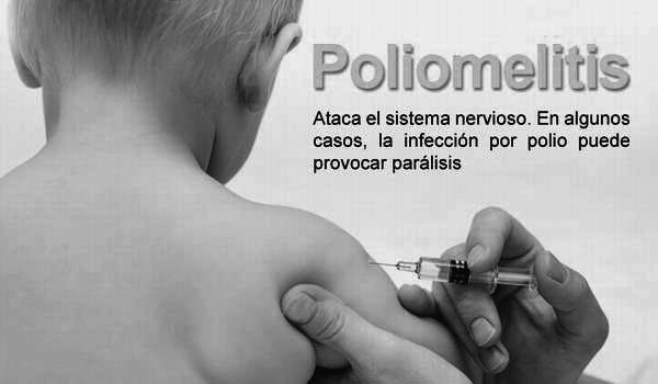 poliomielitis vacunacion enfermedades
